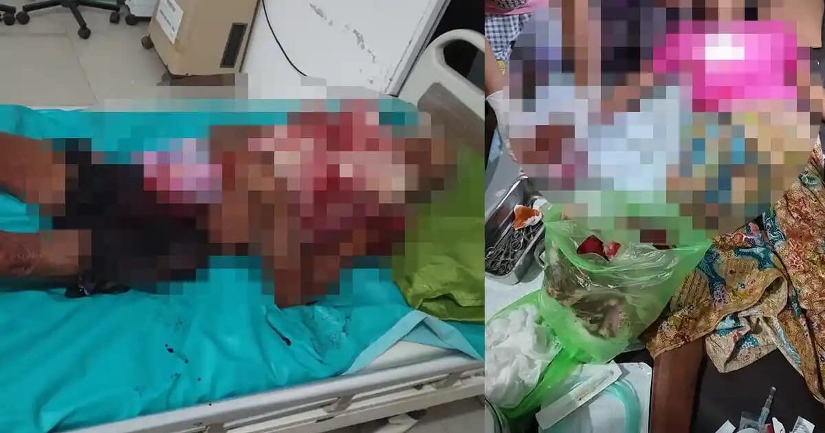Lansia Tewas Dibacok di Jongkong, Istri Kritis