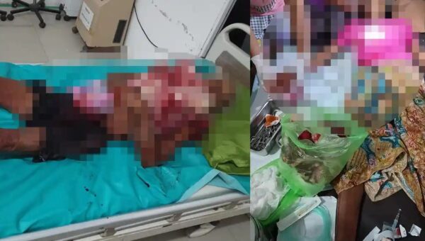 Lansia Tewas Dibacok di Jongkong, Istri Kritis